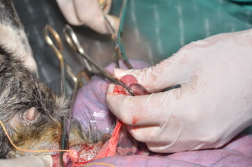 surgical operation to remove the uterus