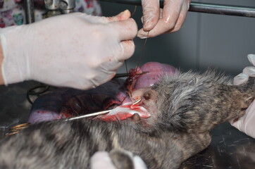 surgical operation to remove the uterus