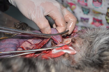surgical operation to remove the uterus