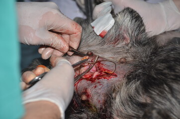 surgical operation to remove the uterus