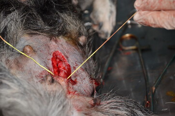 surgical operation to remove the uterus