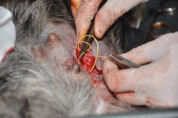surgical operation to remove the uterus