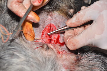 surgical operation to remove the uterus