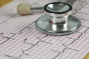 Heart attack concept, Stethoscope on the top of the ECG chart
