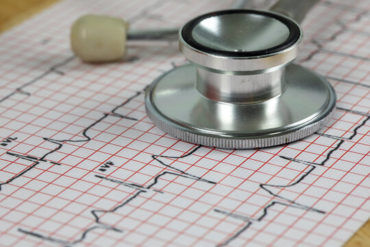 Heart attack concept, Stethoscope on the top of the ECG chart