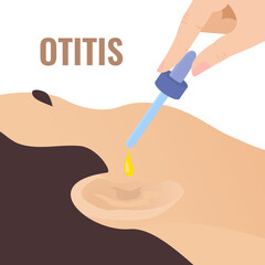Doctor putting in the drops to the patient ear. Otitis disease treatment. Remedy for hearing problems. Earache as a symptom of coronavirus. Medical vector illustration in closeup.