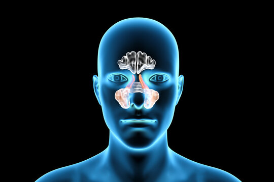 Anatomy of paranasal sinuses