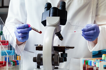 Microbiologist with blood tube test and slide for analysis of antibodies for infectious disease...