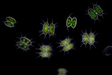 Protozoa and Green Algae in waste water under the microscope.
