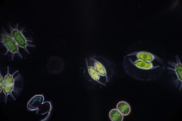 Protozoa and Green Algae in waste water under the microscope.
