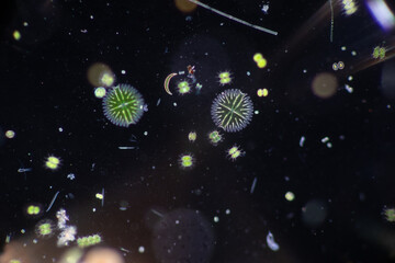 Protozoa and Green Algae in waste water under the microscope.
