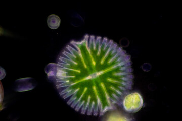 Protozoa and Green Algae in waste water under the microscope.
