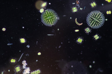 Obraz na płótnie Canvas Protozoa and Green Algae in waste water under the microscope. 