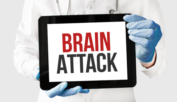 Doctor in holds a tablet with text BRAIN ATTACK