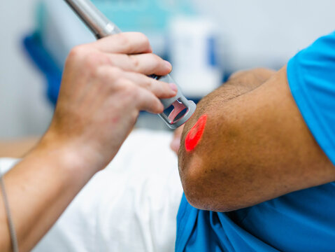 Unrecognizable cropped doctor using laser probe to heal elbow of crop patient during physiotherapy session in modern clinic
