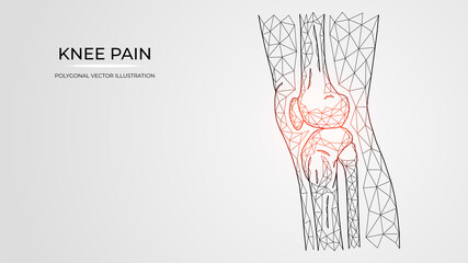 Polygonal vector illustration of pain, inflammation or injury in the knee side view. Human leg bones anatomy. Medical orthopedic diseases templates. - obrazy, fototapety, plakaty