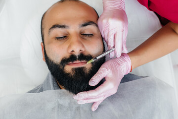 Cosmetic procedure for lip augmentation and wrinkle removal for a bearded man. Cosmetology