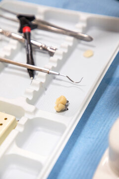 High angle of small artificial teeth placed on table with various dental instruments in clinic