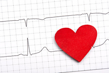Printed ECG, as background
