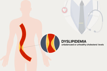 Dyslipidemia, unbalanced and unhealthy cholesterol levels