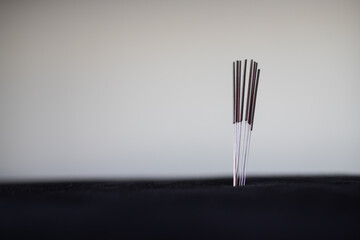 acupuncture therapy