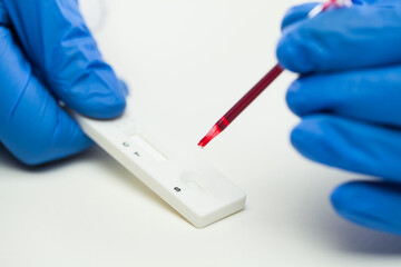 Lab scientist or doctor placing blood sample on Rapid Diagnostic Test RDT cassette