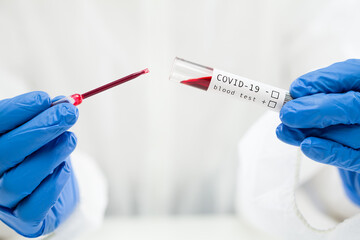 Lab technician dropping blood sample in test tube container using pipette