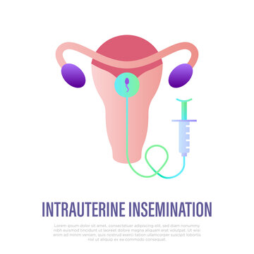 Intrauterine insemination thin line icon. Gynecology. EGG. Uterus and uterine device. Vector illustration.
