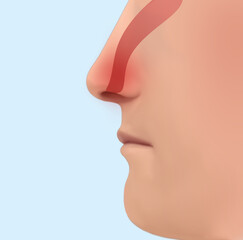 Nasal spray advertisement poster. Illustration of person, focus on nose