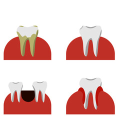Four problems of tooth decay and gum problems