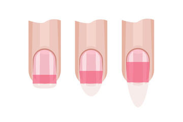 Stress zone of the fingernail. Nail length. Illustration for the manicure guide. Hand nail care .Vector illustration