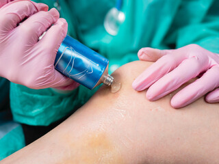 Doctor's hands apply medicinal ointment to the bruise on the patient's leg. Pain, hematoma, first...