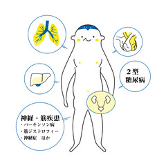 シニア男性をモデルにした基礎疾患の説明図　イラスト
