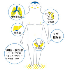 働ぎ盛りの基礎疾患説明図　イラスト
