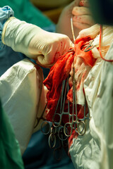 the surgeon fixes the wound with the index finger of his right hand, surgical clamps hang down from the bloody medical bandages to fix the thread for suturing the wound. close-up.