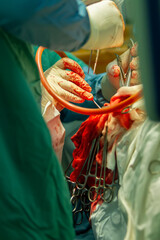the surgeon and the assistant perform the operation with the help of instruments, surgical clamps fixing the thread hang on the bloody medical bandages. close-up.