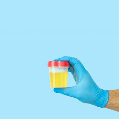 Doctor holding urine sample container for urinalysis