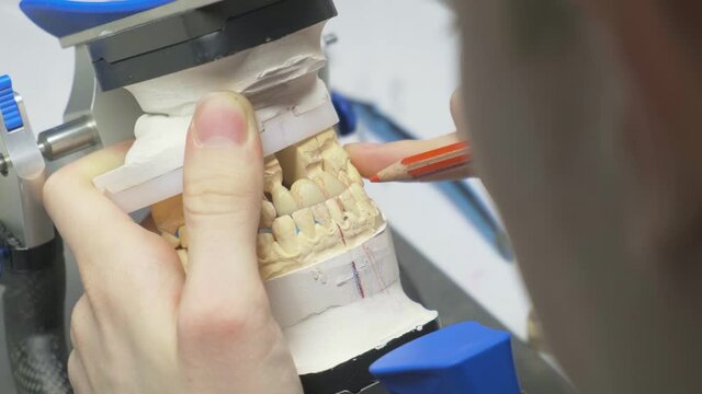 The dentist makes marks on the bite, denture, artificial jaw, denture, hands working on the denture, artificial jaw. Slow motion, close-up.