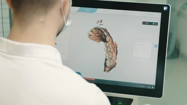 The dentist makes a 3D model of the patient's jaw close-up on the monitor.