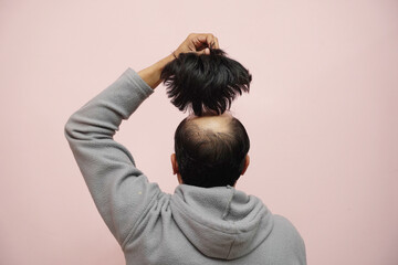 Closeup of a half-bald male removing his wig while wearing a hoodie with a pink background