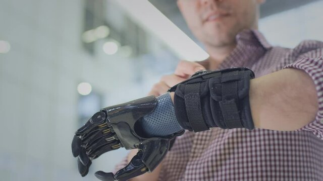 A man with a prosthetic arm uses a smartwatch. Monitors health and heart rate. Writes a message on the display or scrolls the social media app. Technologies for disabled people. Human with a robot arm