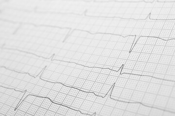 Cardiogram report as background, closeup view. Heart diagnosis