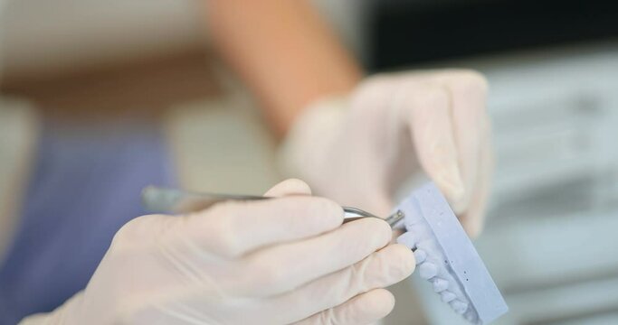 Orthodontist working with jaw model applying brace system, modeling orthodontic treatment for a patient. Dentist working at the laboratory