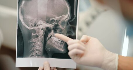 Dentist showing skull x-ray for a young patient during an orthodontic treatment. Girl having a consultation with an orthodontist