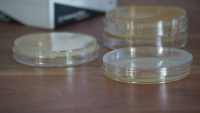 Panning left to right of petri dishes on bench; panning of petri dishes with focus on center dish