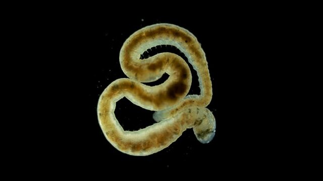 Ophidonais serpentina worm under a microscope, Oligochaeta Subclass, Naididae Family. Sample found in the Volga River