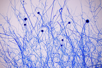 Microscope of black fungus spore strain with Lactophenol cotton blue, molds or yeasts with macro 40x lens, contamination in air room, pollution aerosol environmental. Microbiology laboratory concepts.