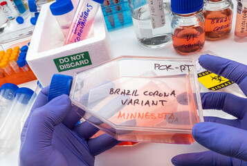 Scientist holds vial of new Brazilian covid-19 strain found in Minnesota in research, concept image