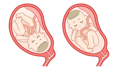 胎児の成長 妊娠2ヶ月 のイラスト テキスト付き Wall Mural 川本まる 胎児の成長 妊娠2ヶ月 のイラスト テキスト付き Wall Mural 川本まる