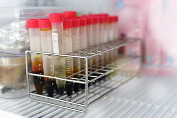 Sample storage tubes arranged in a sieve